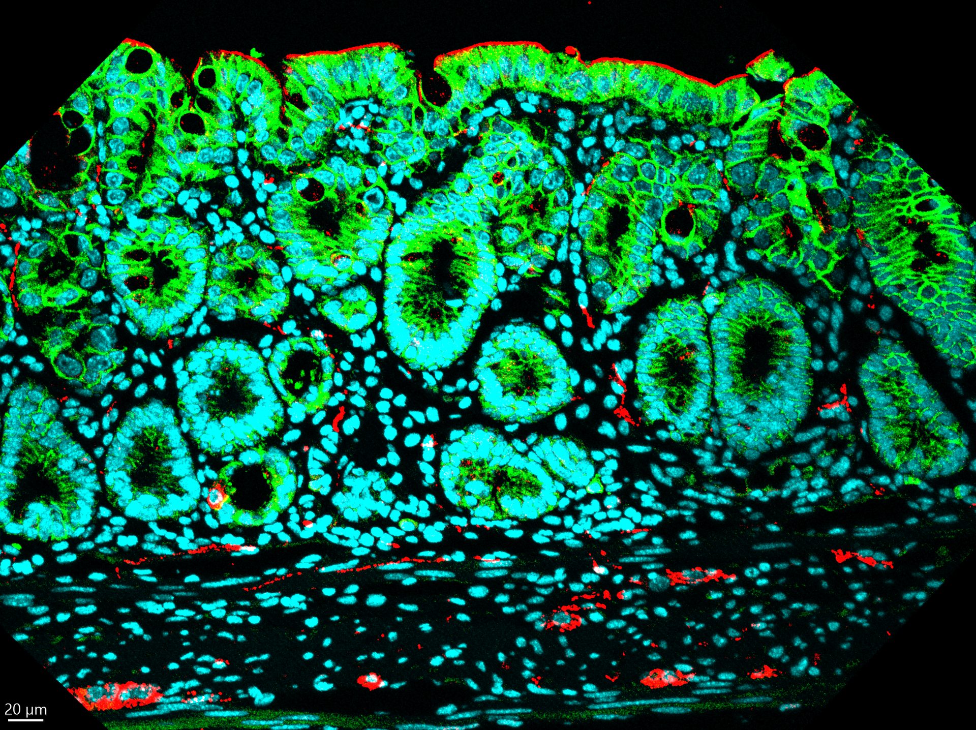 Immunofluorescence — intestinal tissue